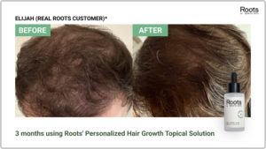 Hair growth topical solution